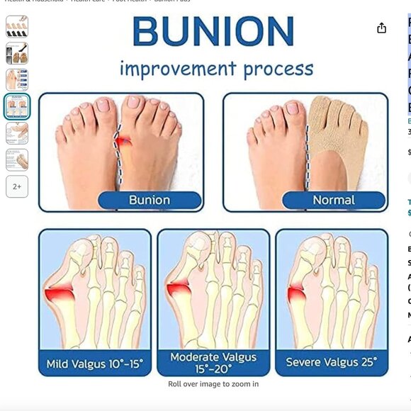 4 PAIRS Bunion Corrector Split Toe Orthopedic Compression Bunions Socks NWT - Picture 4 of 8